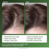 Keshyog Herbal Hair Treatment