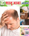 Shanu Baba Hair Treatment